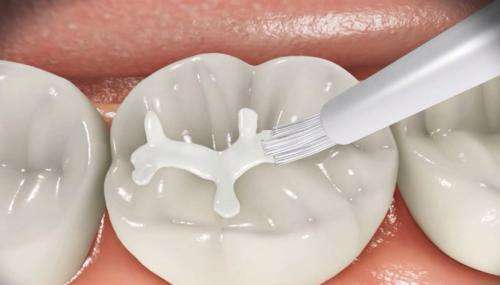 Dentaire Écarteur de bouche Grande / petite taille pour Blanchissement  dentaire Matériel dentaire en france - matérieldentaire.fr